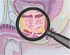 Гардапрост