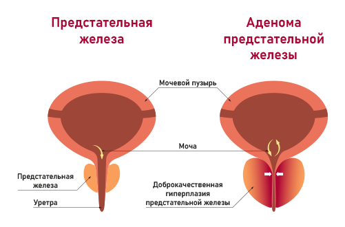 Гардапрост