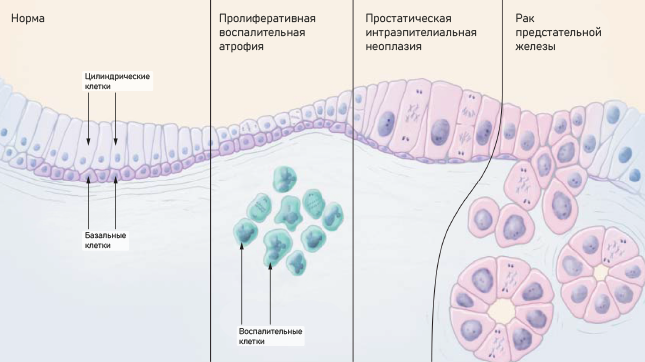 Гардапрост